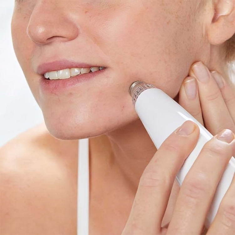 Aspirateur point noir - SkinPerfect™ - Beauté Jouvence